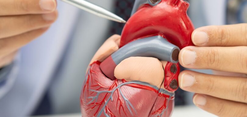 Services: ECG | Echo | Stress Test | Cardiac Surgery