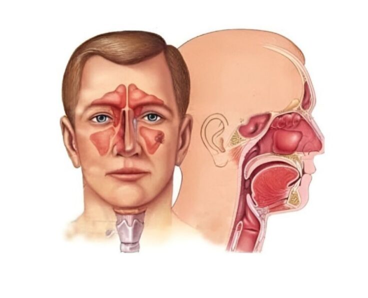 Ear, Nose, and Throat