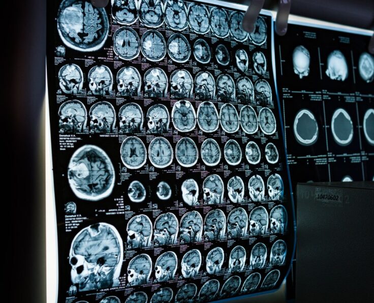 Services: Brain Surgery | Stroke Treatment | Neurological Tests | Rehabilitation