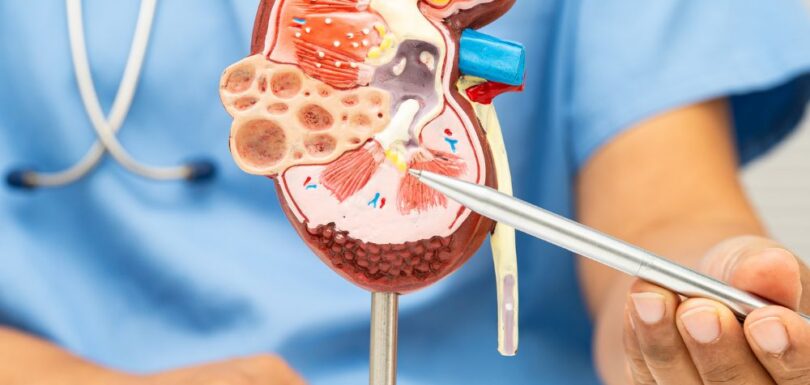 Services: Kidney Treatment | Prostate Care | Urological Surgery | Stone Treatment