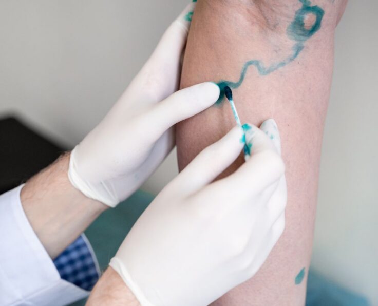 Services: Vascular Surgery | Blood Vessel Treatment | Circulatory Disorders | Surgical Procedures