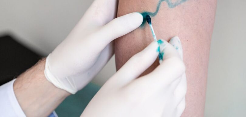 Services: Vascular Surgery | Blood Vessel Treatment | Circulatory Disorders | Surgical Procedures